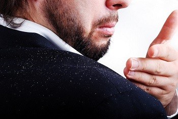 Dandruff Issue On Man's shoulders