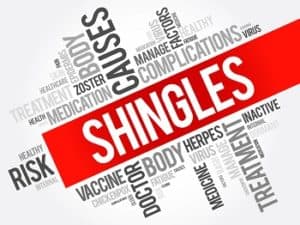 Treating Shingles